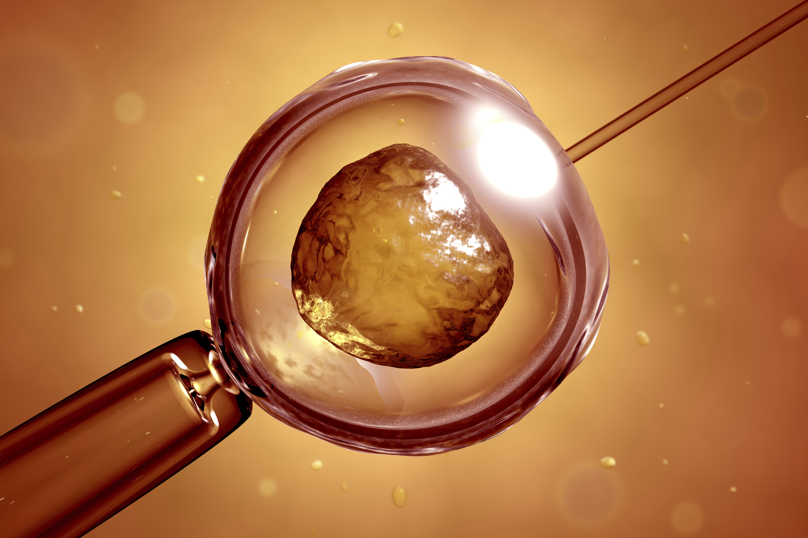 in vitro fertilization