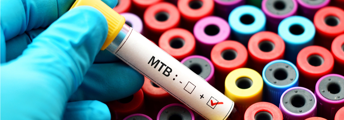 Tuberculosis testing vial
