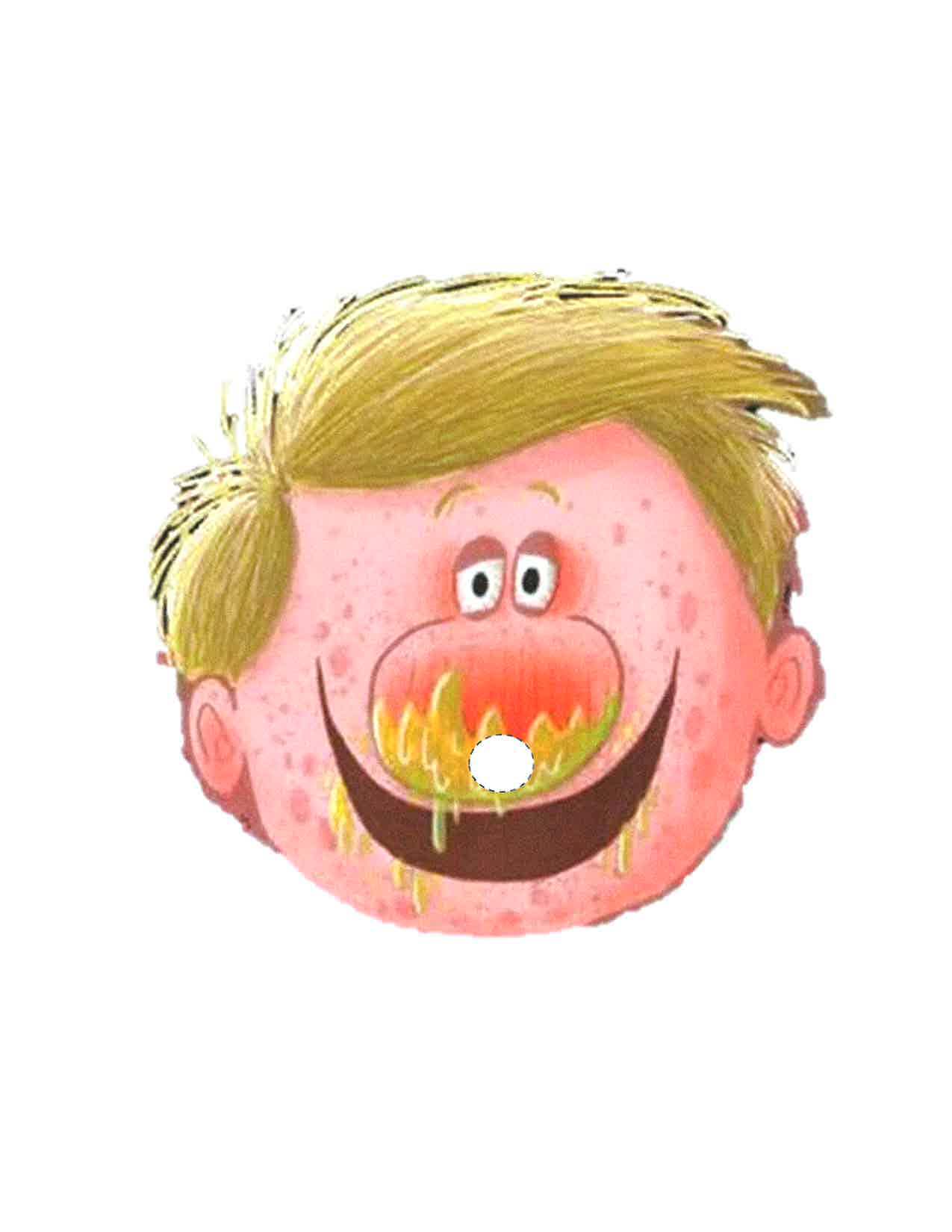 Picture of Sick Simon's face